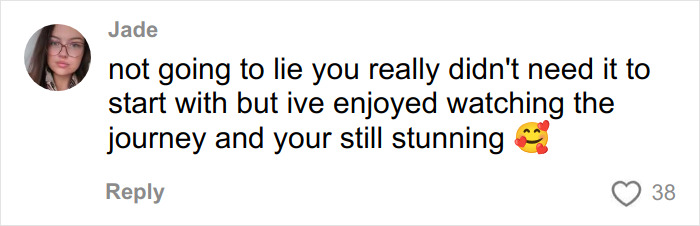 &ldquo;Ridiculously Sad&rdquo;: 28YO Woman&rsquo;s Facelift Sparks Raging Debate As People Question Society&rsquo;s New Normal