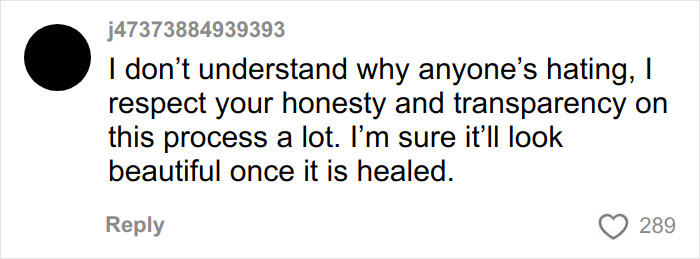 &ldquo;Ridiculously Sad&rdquo;: 28YO Woman&rsquo;s Facelift Sparks Raging Debate As People Question Society&rsquo;s New Normal