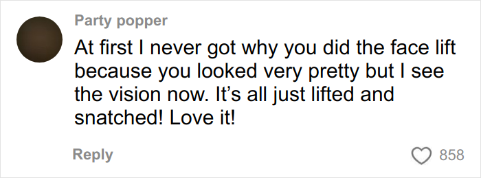 &ldquo;Ridiculously Sad&rdquo;: 28YO Woman&rsquo;s Facelift Sparks Raging Debate As People Question Society&rsquo;s New Normal