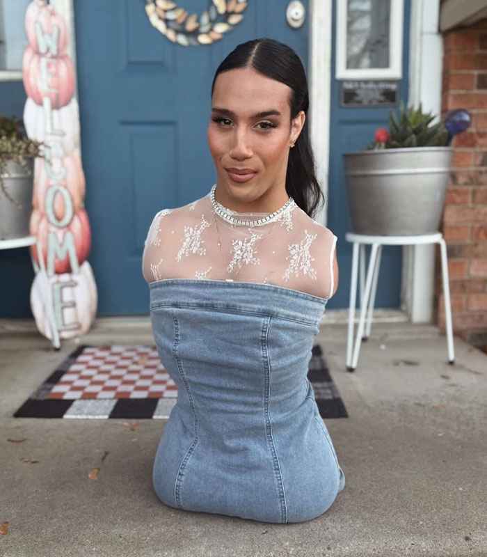 Trans Influencer With No Limbs Reveals What “Everyone Wants To Know” About Life With Husband After Transitioning