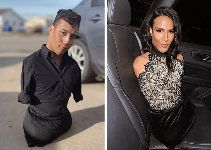 Trans Influencer With No Limbs Reveals What “Everyone Wants To Know” About Life With Husband After Transitioning