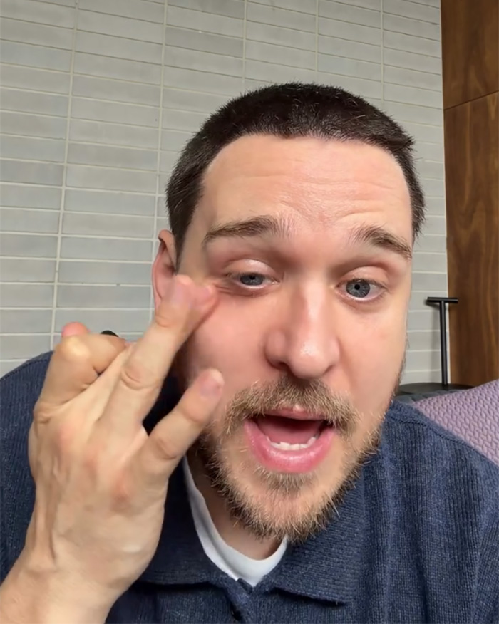 Celebrity Skincare Expert’s ‘Genius’ Lip Balm Hack Could Save You Hundreds Per Year