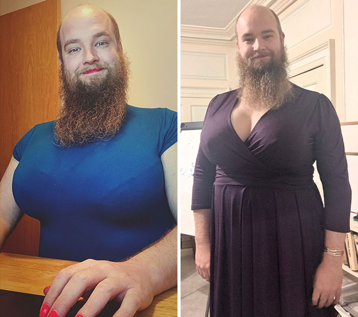 “Insult To Women”: Male Lecturer Wears Fake Breasts And Major Cleavage, University Of Oxford Brutally Slammed