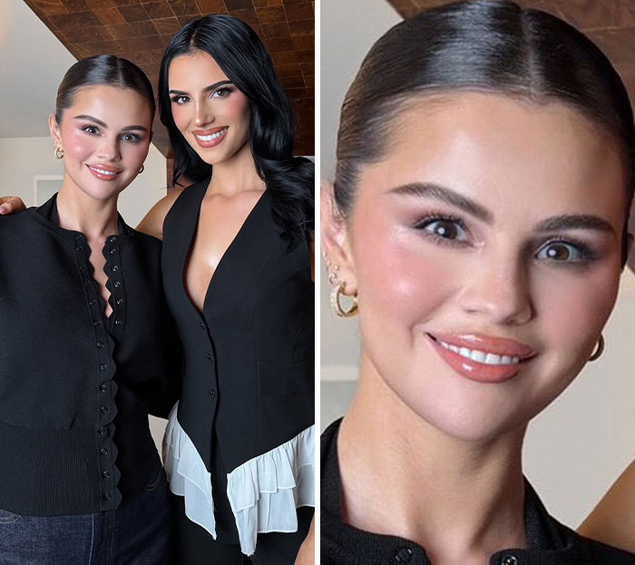 Selena Gomez’s New Photo Reveals Surprising Plastic Surgery, Fans Claim
