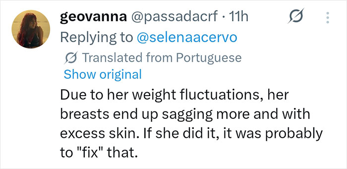 Selena Gomez’s New Photo Reveals Surprising Plastic Surgery, Fans Claim