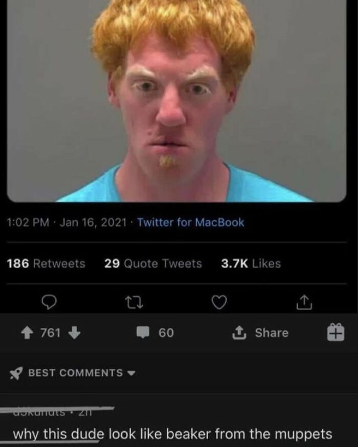 63 Rare Burns That Hit So Hard, People Didn&rsquo;t Even Know How To Respond