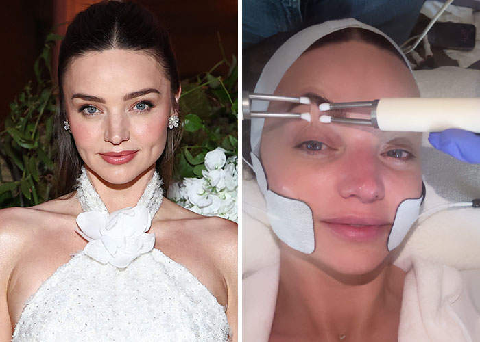 Met Gala 2026 Was More About Plastic Surgery Than Fashion As Stars Showed Off Their Procedures