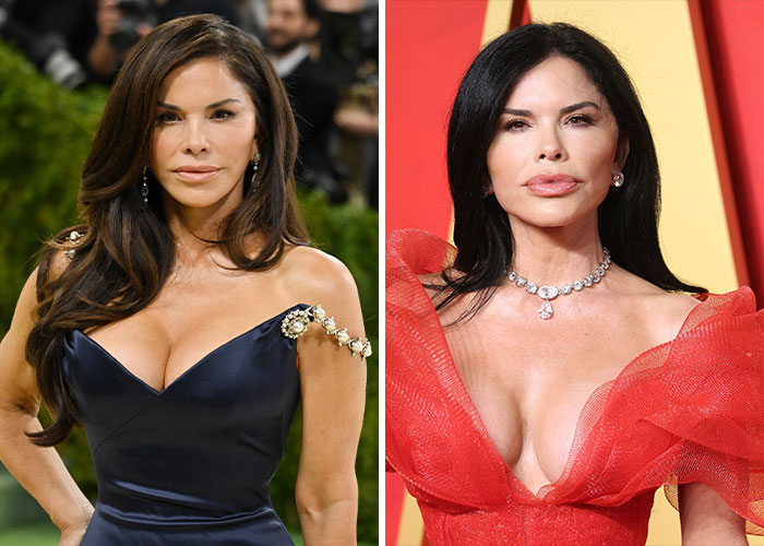 Met Gala 2026 Was More About Plastic Surgery Than Fashion As Stars Showed Off Their Procedures