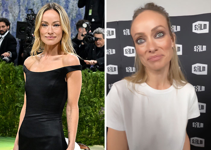 Met Gala 2026 Was More About Plastic Surgery Than Fashion As Stars Showed Off Their Procedures