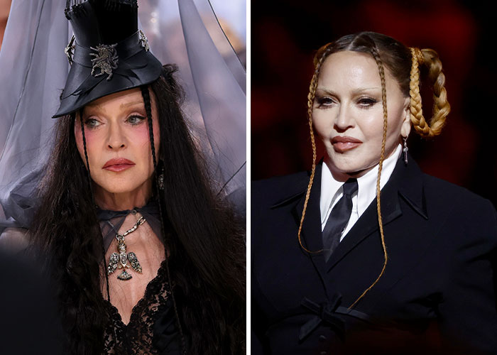 Met Gala 2026 Was More About Plastic Surgery Than Fashion As Stars Showed Off Their Procedures