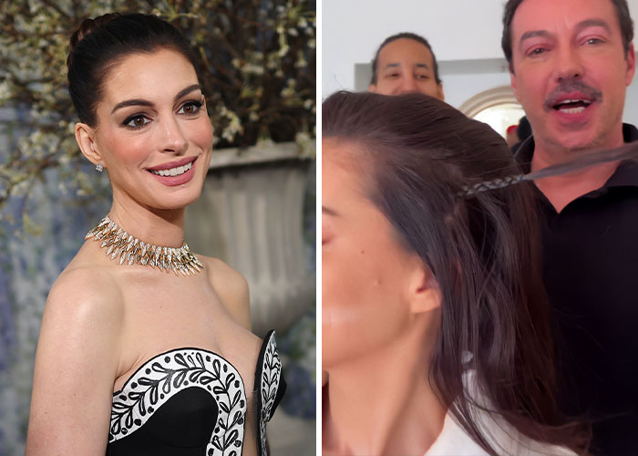 Met Gala 2026 Was More About Plastic Surgery Than Fashion As Stars Showed Off Their Procedures