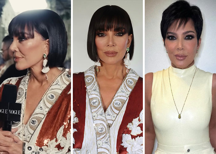 Met Gala 2026 Was More About Plastic Surgery Than Fashion As Stars Showed Off Their Procedures