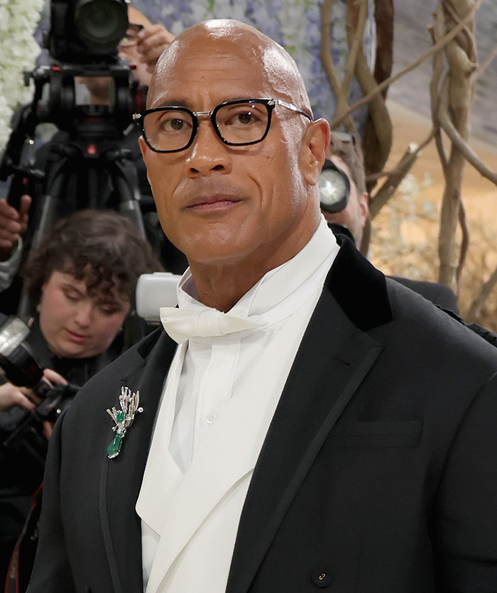 Met Gala 2026 Was More About Plastic Surgery Than Fashion As Stars Showed Off Their Procedures