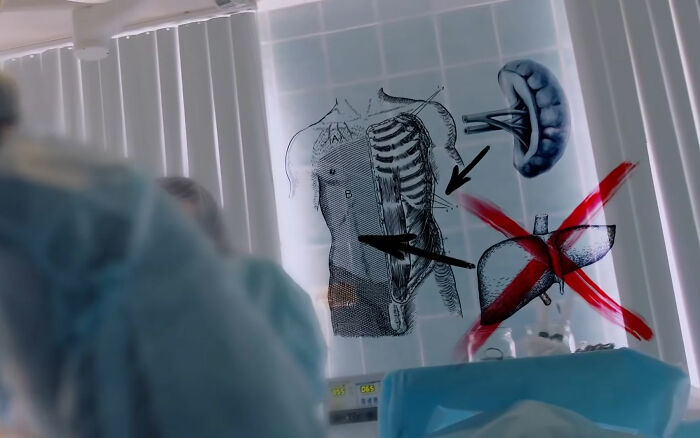 Surgeon Has Bizarre Excuse For Fatally Removing The Wrong Organ From Patient