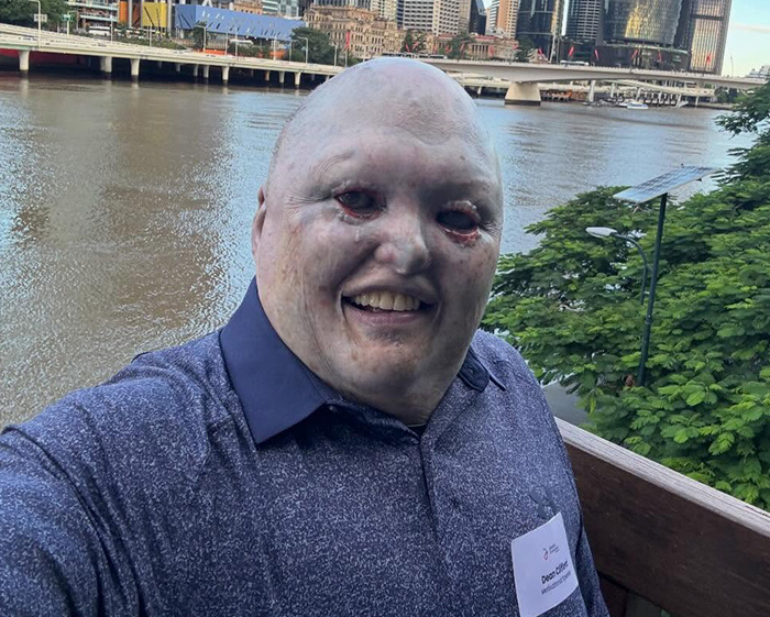 Man Has Inspiring Response After Meta AI’s ‘Appalling’ Insult Results In Barrage Of Trolls