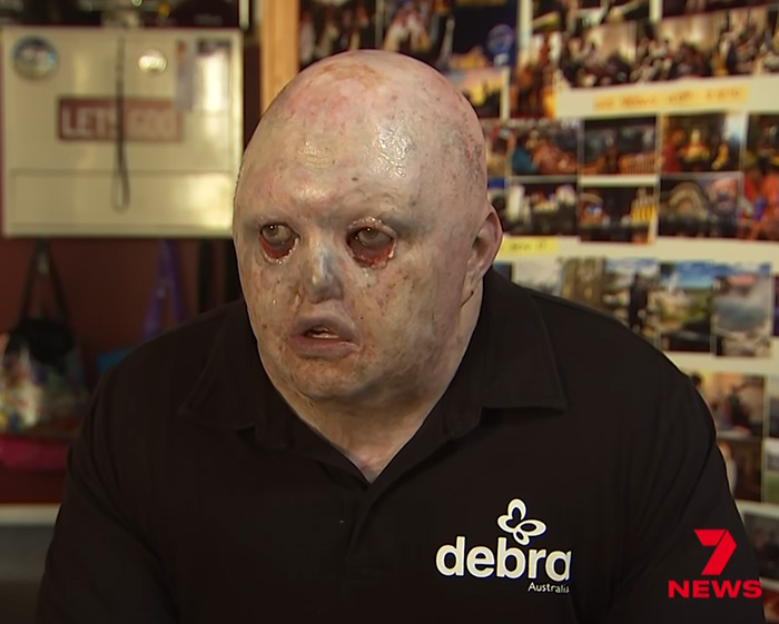 Man Has Inspiring Response After Meta AI’s ‘Appalling’ Insult Results In Barrage Of Trolls