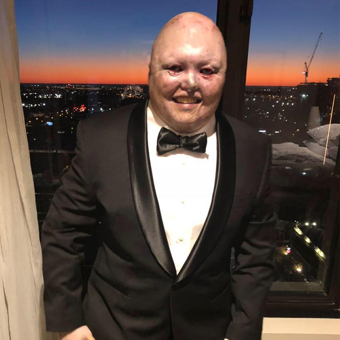Man Has Inspiring Response After Meta AI’s ‘Appalling’ Insult Results In Barrage Of Trolls