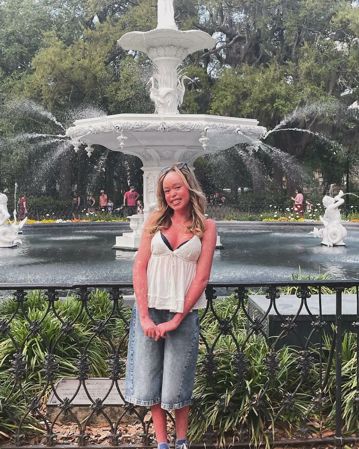 Teen Shows The Only Way She Can Control Her Rare Skin Condition, Shocks Doctors With Her Routine