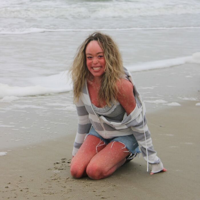 Teen Shows The Only Way She Can Control Her Rare Skin Condition, Shocks Doctors With Her Routine
