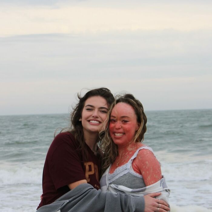 Teen Shows The Only Way She Can Control Her Rare Skin Condition, Shocks Doctors With Her Routine
