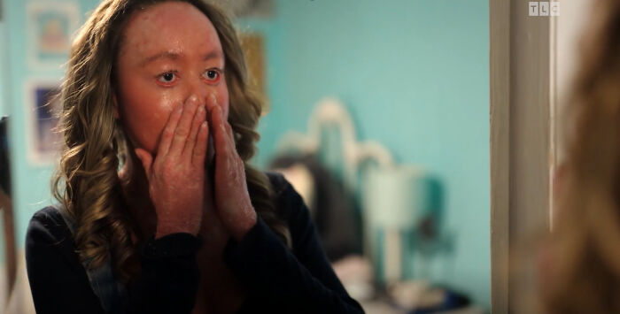 Teen Shows The Only Way She Can Control Her Rare Skin Condition, Shocks Doctors With Her Routine