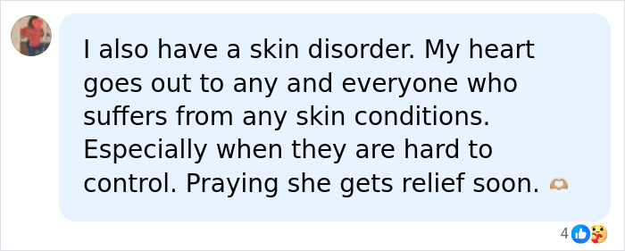 Teen Shows The Only Way She Can Control Her Rare Skin Condition, Shocks Doctors With Her Routine