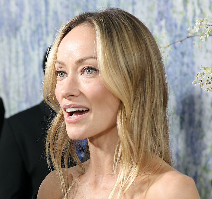 &ldquo;Worse Than Ariana Grande&rdquo;: Medical Experts Weigh In On Olivia Wilde&rsquo;s Recent Dramatic Transformation