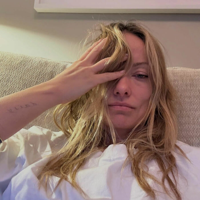 &ldquo;Worse Than Ariana Grande&rdquo;: Medical Experts Weigh In On Olivia Wilde&rsquo;s Recent Dramatic Transformation