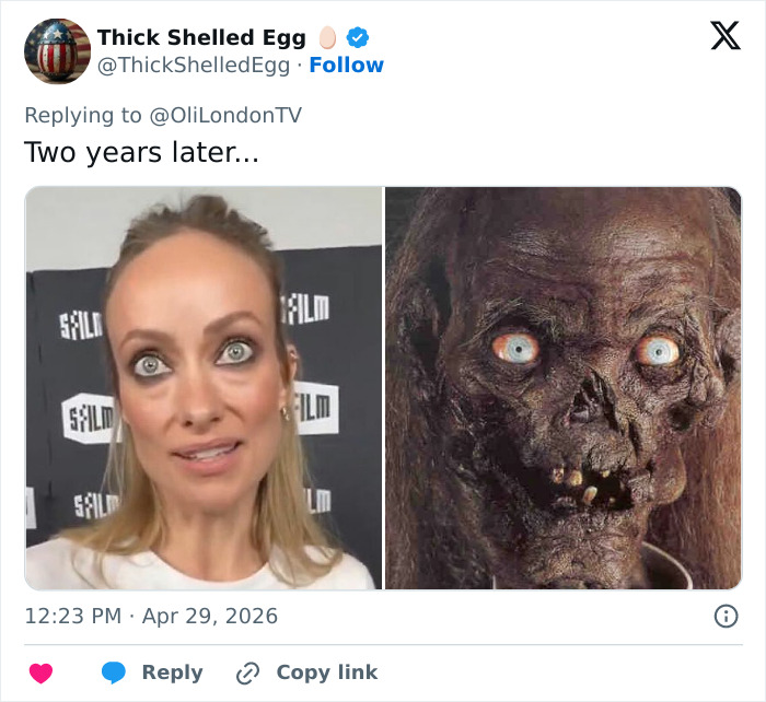 &ldquo;Worse Than Ariana Grande&rdquo;: Medical Experts Weigh In On Olivia Wilde&rsquo;s Recent Dramatic Transformation