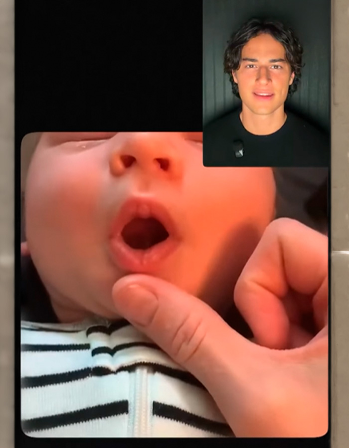 Parents Are Using &ldquo;Looksmaxxing&rdquo; Tricks On Their Babies As Experts Sound Alarm Over Dangerous Obsession