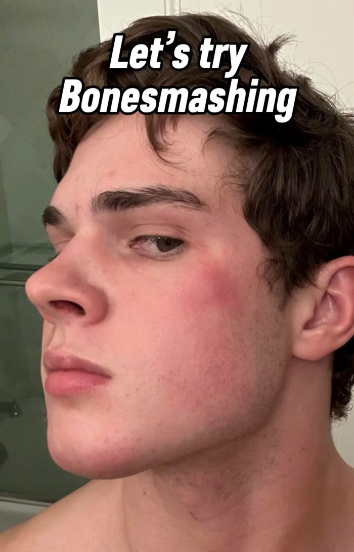 Parents Are Using &ldquo;Looksmaxxing&rdquo; Tricks On Their Babies As Experts Sound Alarm Over Dangerous Obsession