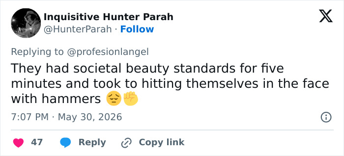 Parents Are Using &ldquo;Looksmaxxing&rdquo; Tricks On Their Babies As Experts Sound Alarm Over Dangerous Obsession