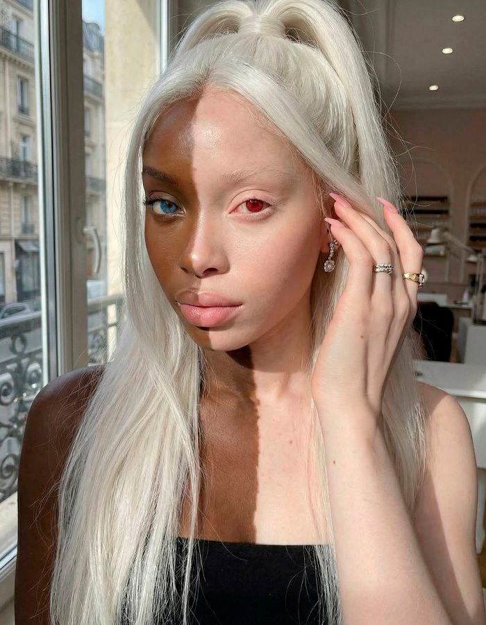 Model Goes Viral For Her Strikingly Unusual Skin Coloration, But There’s A Twist Model Goes Viral For Her Strikingly Unusual Skin Coloration, But There’s A Twist