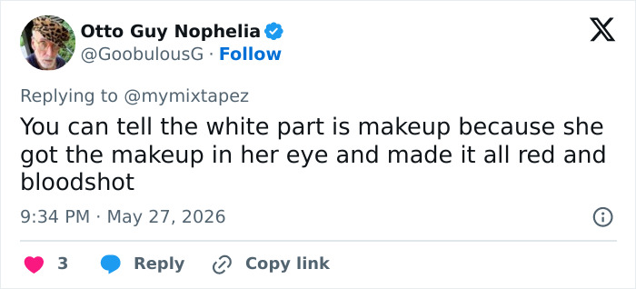 Model Goes Viral For Her Strikingly Unusual Skin Coloration, But There’s A Twist Model Goes Viral For Her Strikingly Unusual Skin Coloration, But There’s A Twist