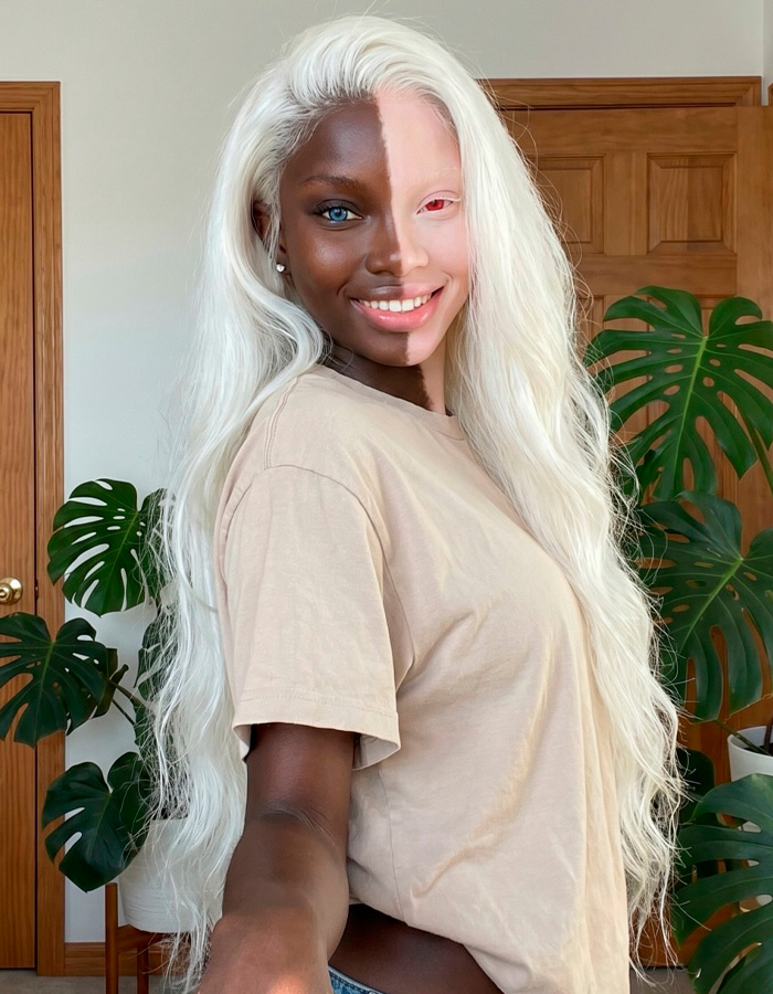 Model Goes Viral For Her Strikingly Unusual Skin Coloration, But There’s A Twist Model Goes Viral For Her Strikingly Unusual Skin Coloration, But There’s A Twist