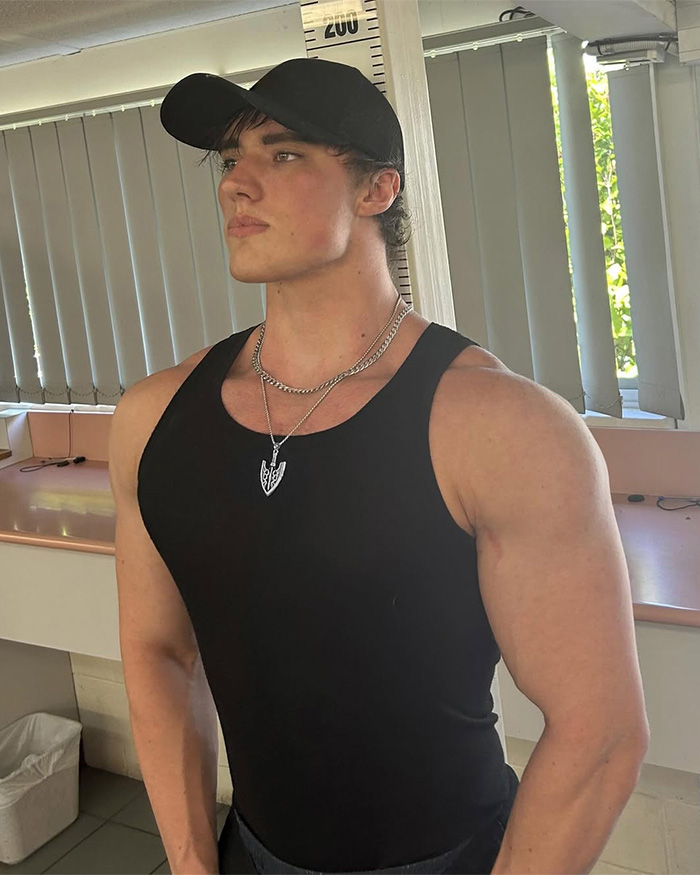 Looksmaxxer Androgenic Fights Flight Attendant And Gets Kicked Off Plane Shortly After Getting Plastic Surgery Looksmaxxer Androgenic Fights Flight Attendant And Gets Kicked Off Plane Shortly After Getting Plastic Surgery