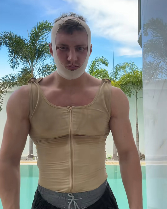 Looksmaxxer Androgenic Fights Flight Attendant And Gets Kicked Off Plane Shortly After Getting Plastic Surgery Looksmaxxer Androgenic Fights Flight Attendant And Gets Kicked Off Plane Shortly After Getting Plastic Surgery