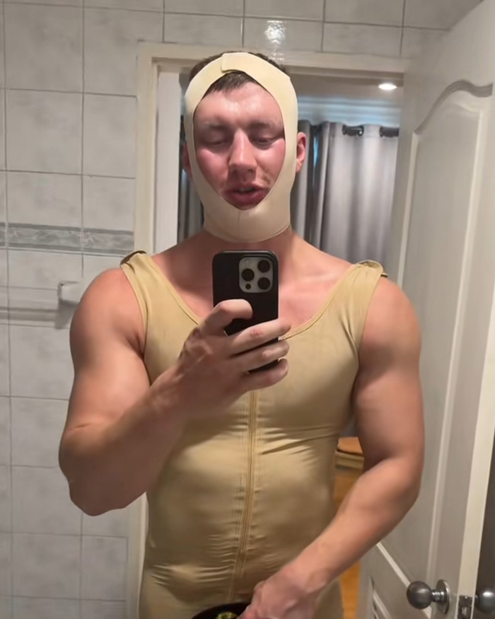 Looksmaxxer Androgenic Fights Flight Attendant And Gets Kicked Off Plane Shortly After Getting Plastic Surgery Looksmaxxer Androgenic Fights Flight Attendant And Gets Kicked Off Plane Shortly After Getting Plastic Surgery