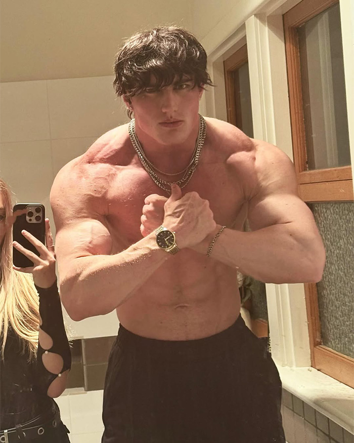Looksmaxxer Androgenic Fights Flight Attendant And Gets Kicked Off Plane Shortly After Getting Plastic Surgery Looksmaxxer Androgenic Fights Flight Attendant And Gets Kicked Off Plane Shortly After Getting Plastic Surgery