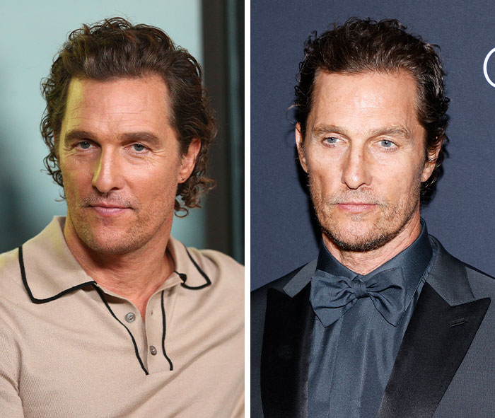 Doctor Exposes Real Reason Male Celebs Look Unrecognizable As Jim Carrey And Matthew McConaughey Raise Alarm Doctor Exposes Real Reason Male Celebs Look Unrecognizable As Jim Carrey And Matthew McConaughey Raise Alarm