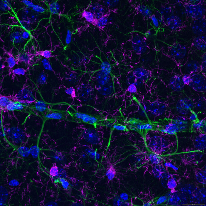 Evident Scientific’s 2025 Image Of The Year Award: 17 Pics Revealing The Beauty Of Science Evident Scientific’s 2025 Image Of The Year Award: 17 Pics Revealing The Beauty Of Science