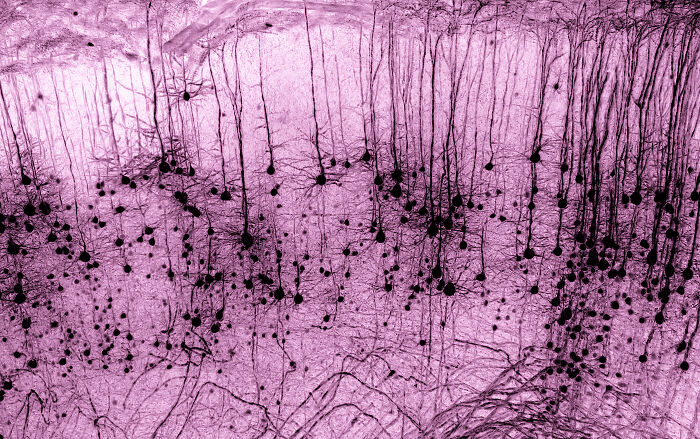 Evident Scientific’s 2025 Image Of The Year Award: 17 Pics Revealing The Beauty Of Science Evident Scientific’s 2025 Image Of The Year Award: 17 Pics Revealing The Beauty Of Science