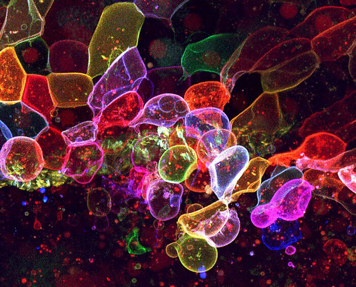 Evident Scientific’s 2025 Image Of The Year Award: 17 Pics Revealing The Beauty Of Science Evident Scientific’s 2025 Image Of The Year Award: 17 Pics Revealing The Beauty Of Science
