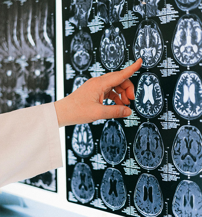 &ldquo;Once It&rsquo;s Gone, It&rsquo;s Gone&rdquo;: The Silent Brain-Sapper Striking Millions of Postmenopausal Women