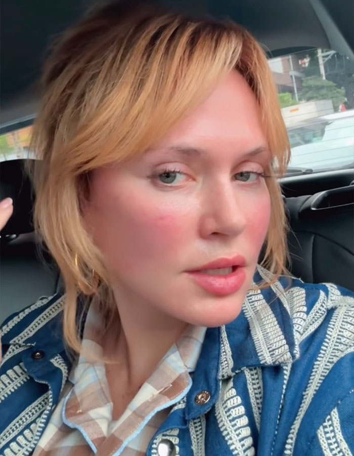 US Influencer Found Under Disturbing Circumstances At 5-Star Hotel After Flying To Brazil For Plastic Surgery