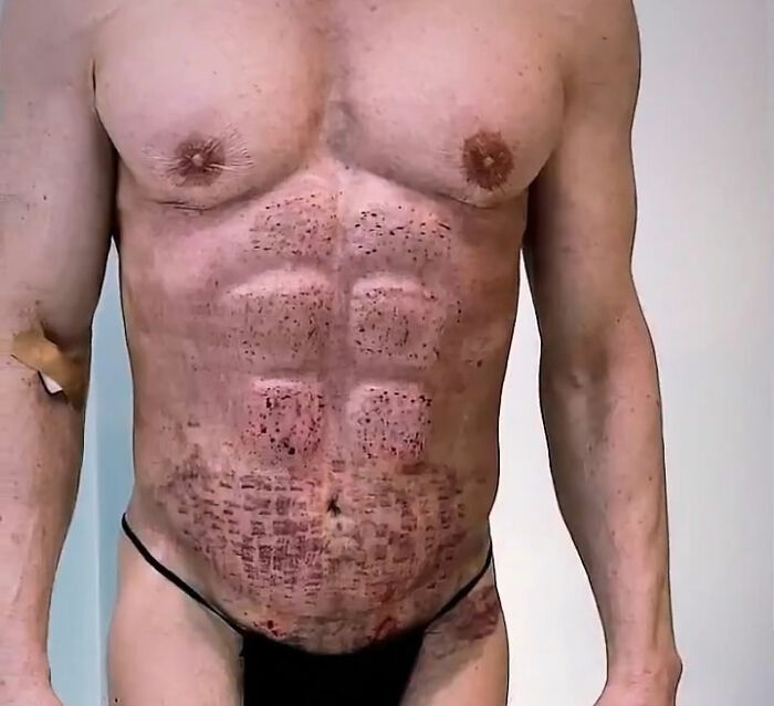 “Time For The Apocalypse”: Man Shows Off His Ab Implants And The Internet Is Collectively Shaking Its Head “Time For The Apocalypse”: Man Shows Off His Ab Implants And The Internet Is Collectively Shaking Its Head