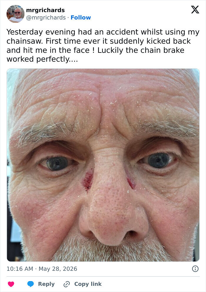 64 Risky Situations That Made People Question How These Folks Have Survived This Long