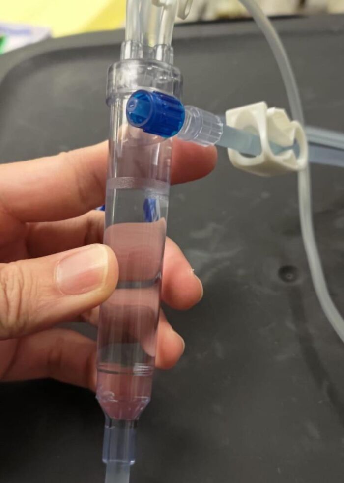 64 Risky Situations That Made People Question How These Folks Have Survived This Long