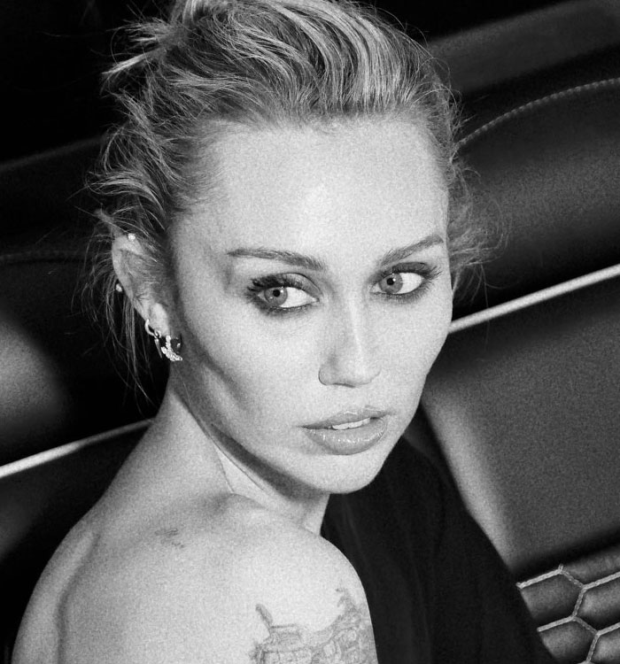 “Lost Another Baddie To Buccal Fat Removal”: 28 Celebrity Collages That Put Rumored Plastic Surgery On Display