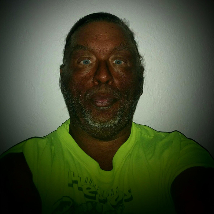 “Breaking New Ground”: Man Reveals Results After Injecting Himself With Unregulated Tanning Peptide Melanotan 2